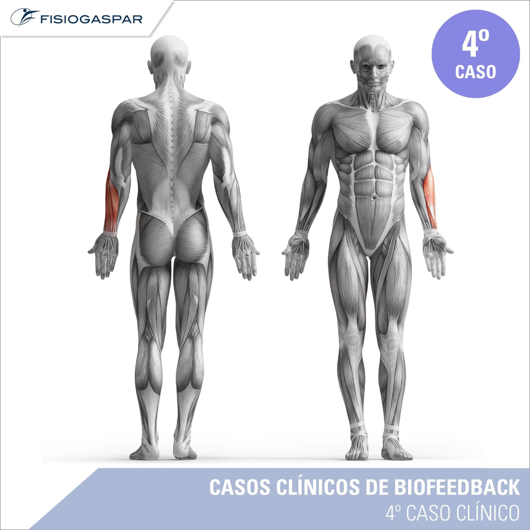 quarto caso clínico de biofeedback