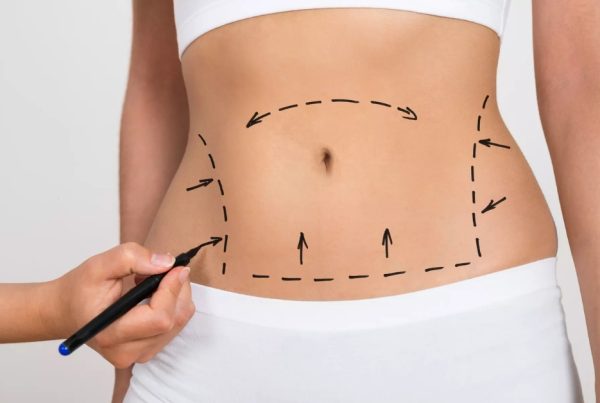 Principais razões para considerar Lisboa para o seu procedimento de lipoaspiração